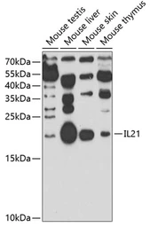 Anti-IL21 antibody used in Western Blot (WB). GTX33263