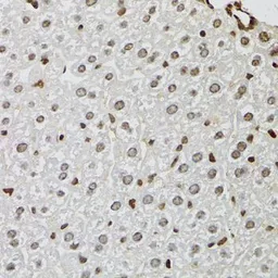 Anti-KDM4A antibody used in IHC (Paraffin sections) (IHC-P). GTX33282