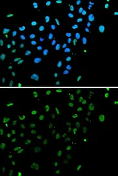 Anti-Ku80 antibody used in Immunocytochemistry/ Immunofluorescence (ICC/IF). GTX33290