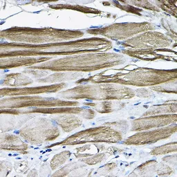 Anti-LDB3 antibody used in IHC (Paraffin sections) (IHC-P). GTX33294