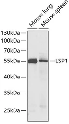 Anti-LSP1 antibody used in Western Blot (WB). GTX33304