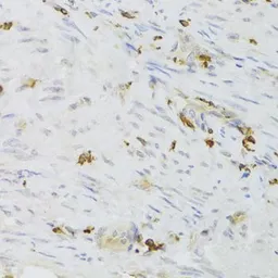 Anti-LSP1 antibody used in IHC (Paraffin sections) (IHC-P). GTX33304