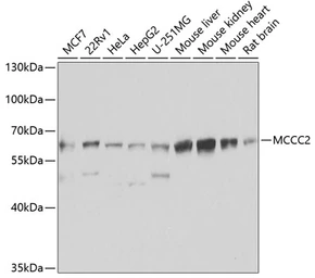 Anti-MCCC2 antibody used in Western Blot (WB). GTX33308
