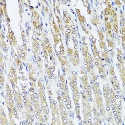 Anti-MCCC2 antibody used in IHC (Paraffin sections) (IHC-P). GTX33308