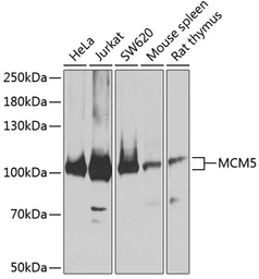 Anti-MCM5 antibody used in Western Blot (WB). GTX33310