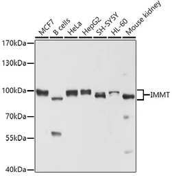 Anti-Mitofilin antibody used in Western Blot (WB). GTX33318