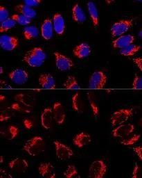 Anti-Mitofilin antibody used in Immunocytochemistry/ Immunofluorescence (ICC/IF). GTX33318