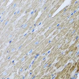 Anti-MTX2 antibody used in IHC (Paraffin sections) (IHC-P). GTX33333