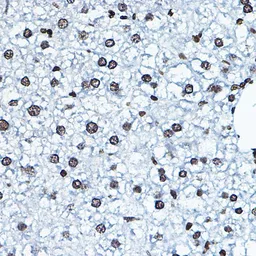 Anti-MYST2 antibody used in IHC (Paraffin sections) (IHC-P). GTX33341