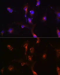 Anti-NFS1 antibody used in Immunocytochemistry/ Immunofluorescence (ICC/IF). GTX33356
