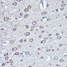 Anti-NFS1 antibody used in IHC (Paraffin sections) (IHC-P). GTX33356