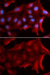 Anti-NQO2 antibody used in Immunocytochemistry/ Immunofluorescence (ICC/IF). GTX33363