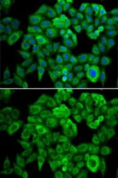 Anti-OGDH antibody used in Immunocytochemistry/ Immunofluorescence (ICC/IF). GTX33374