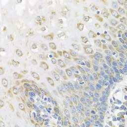 Anti-PABPC4 antibody used in IHC (Paraffin sections) (IHC-P). GTX33380
