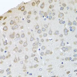 Anti-PABPC4 antibody used in IHC (Paraffin sections) (IHC-P). GTX33380