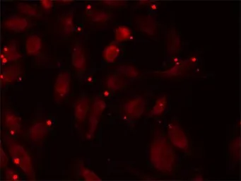 Anti-PCCB antibody used in Immunocytochemistry/ Immunofluorescence (ICC/IF). GTX33390