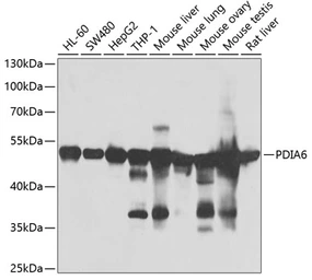 Anti-PDIA6 antibody used in Western Blot (WB). GTX33397