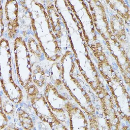 Anti-PP2A beta antibody used in IHC (Paraffin sections) (IHC-P). GTX33421