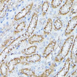 Anti-PP2A beta antibody used in IHC (Paraffin sections) (IHC-P). GTX33421