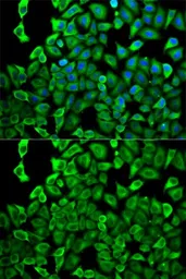 Anti-PSMD2 antibody used in Immunocytochemistry/ Immunofluorescence (ICC/IF). GTX33439