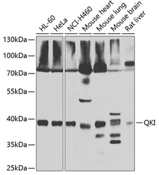 Anti-QKI antibody used in Western Blot (WB). GTX33450