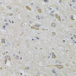 Anti-RAB17 antibody used in IHC (Paraffin sections) (IHC-P). GTX33451