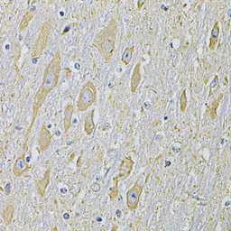 Anti-RAB17 antibody used in IHC (Paraffin sections) (IHC-P). GTX33451