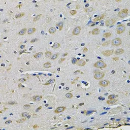 Anti-RAB17 antibody used in IHC (Paraffin sections) (IHC-P). GTX33451