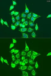Anti-RASGRP3 antibody used in Immunocytochemistry/ Immunofluorescence (ICC/IF). GTX33459
