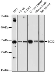 Anti-SCO2 antibody used in Western Blot (WB). GTX33486