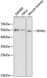 Anti-SPHK1 antibody used in Western Blot (WB). GTX33516