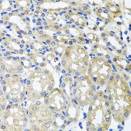 Anti-ST8SIA2 antibody used in IHC (Paraffin sections) (IHC-P). GTX33522
