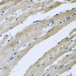 Anti-ST8SIA2 antibody used in IHC (Paraffin sections) (IHC-P). GTX33522