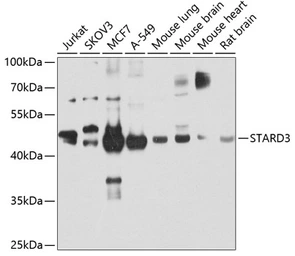 Anti-STARD3 antibody used in Western Blot (WB). GTX33525