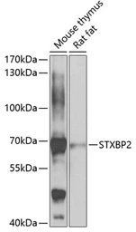 Anti-STXBP2 antibody used in Western Blot (WB). GTX33529