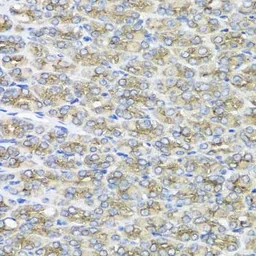 Anti-STXBP2 antibody used in IHC (Paraffin sections) (IHC-P). GTX33529