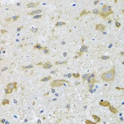 Anti-TCP1 delta antibody used in IHC (Paraffin sections) (IHC-P). GTX33536