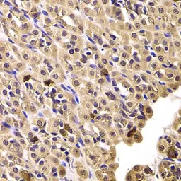 Anti-TCP1 delta antibody used in IHC (Paraffin sections) (IHC-P). GTX33536