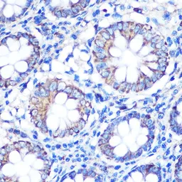 Anti-TFEB antibody used in IHC (Paraffin sections) (IHC-P). GTX33541