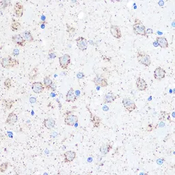 Anti-TFEB antibody used in IHC (Paraffin sections) (IHC-P). GTX33541