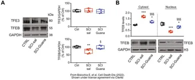Anti-TFEB antibody used in Western Blot (WB). GTX33541