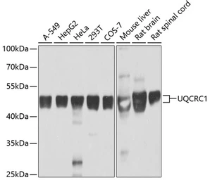 Anti-UQCRC1 antibody used in Western Blot (WB). GTX33572