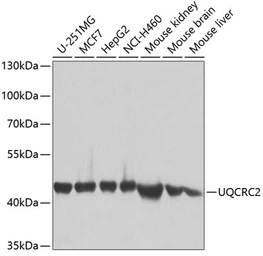Anti-UQCRC2 antibody used in Western Blot (WB). GTX33573