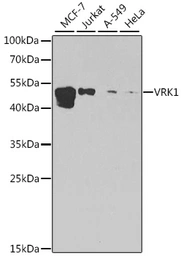 Anti-VRK1 antibody used in Western Blot (WB). GTX33581