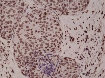 Anti-p38 MAPK (phospho Thr180/Tyr182) antibody [RM243] used in IHC (Paraffin sections) (IHC-P). GTX33599