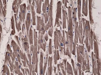 Anti-Acetyl-CoA Carboxylase 1 antibody [RM232] used in IHC (Paraffin sections) (IHC-P). GTX33608