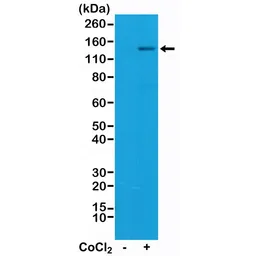 Anti-HIF1 alpha antibody [RM242] used in Western Blot (WB). GTX33617