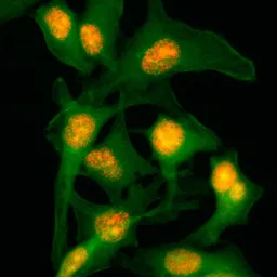 Anti-Histone H2B antibody [RM230] used in Immunocytochemistry/ Immunofluorescence (ICC/IF). GTX33619