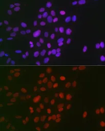Anti-Histone H3R26me2 (Symmetric Di-methyl Arg26) antibody used in Immunocytochemistry/ Immunofluorescence (ICC/IF). GTX33908