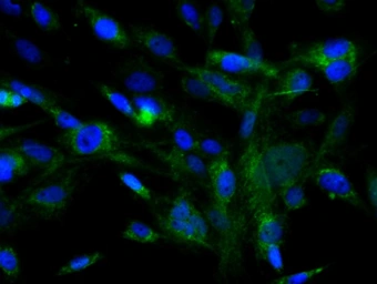 Anti-c-Kit antibody used in Immunocytochemistry/ Immunofluorescence (ICC/IF). GTX33947